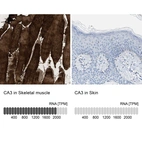 Anti-CA3 Antibody