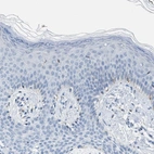 Immunohistochemical staining of human skin shows low expression as expected.