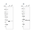 Western blot analysis using Anti-CA3 antibody HPA021775 (A) shows similar pattern to independent antibody HPA026700 (B).