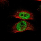 Immunofluorescent staining of human cell line U-251 MG shows localization to nucleoplasm.