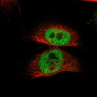 Immunofluorescent staining of human cell line U-251 MG shows localization to nucleoplasm.