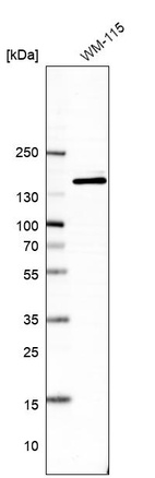 Western blot analysis in human cell line WM-115.