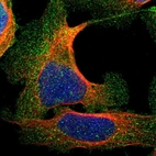 Immunofluorescent staining of human cell line U-2 OS shows localization to plasma membrane & cytosol.
