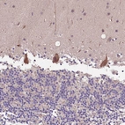 Immunohistochemical staining of human cerebellum shows strong cytoplasmic positivity in Purkinje cells.