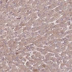Immunohistochemical staining of human liver shows moderate cytoplasmic positivity in hepatocytes.