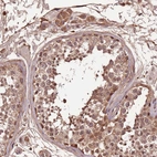 Immunohistochemical staining of human testis shows strong cytoplasmic positivity in cells in seminiferous ducts and Leydig cells.