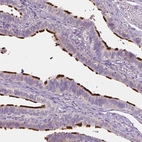 Immunohistochemical staining of human fallopian tube shows high expression.