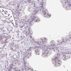 Immunohistochemical staining of human prostate shows low expression as expected.