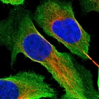 Immunofluorescent staining of human cell line U-2 OS shows localization to plasma membrane & cytosol.