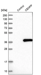 Western blot analysis in control (vector only transfected HEK293T lysate) and CENPP over-expression lysate (Co-expressed with a C-terminal myc-DDK tag (~3.1 kDa) in mammalian HEK293T cells, LY423313).