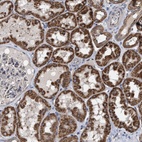 Anti-EXOSC2 Antibody
