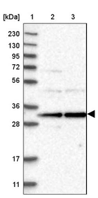 Lane 1: Marker [kDa] 230, 130, 95, 72, 56, 36, 28, 17, 11_br/_Lane 2: Human cell line RT-4_br/_Lane 3: Human cell line U-251MG sp