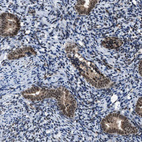 Immunohistochemical staining of human endometrium shows strong nuclear positivity in glandular cells.
