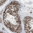 Immunohistochemical staining of human testis shows strong nuclear positivity in cells in seminiferous ducts.