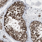 Immunohistochemical staining of human testis shows strong nuclear positivity in cells in seminiferous ducts.