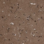 Immunohistochemical staining of human cerebral cortex shows strong nuclear positivity in neurons.