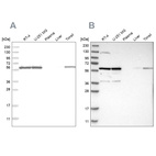 Western blot analysis using Anti-PRPF4 antibody HPA021794 (A) shows similar pattern to independent antibody HPA022248 (B).