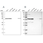 Western blot analysis using Anti-PRPF4 antibody HPA021794 (A) shows similar pattern to independent antibody HPA022248 (B).