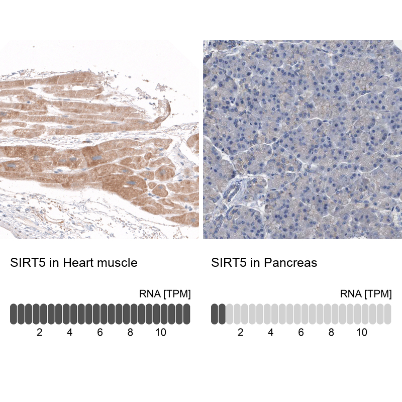 Anti-SIRT5 Antibody