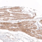 Immunohistochemical staining of human heart muscle shows moderate to strong granular cytoplasmic positivity.