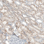Immunohistochemical staining of human kidney shows moderate to strong granular cytoplasmic positivity in cells in tubules.