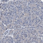 Immunohistochemical staining of human pancreas shows no positivity in exocrine glandular cells as expected.