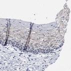 Immunohistochemical staining of human cervix, uterine shows strong granular cytoplasmic positivity in squamous epithelial cells.