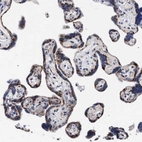 Immunohistochemical staining of human placenta shows strong granular cytoplasmic positivity in trophoblastic cells.