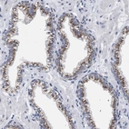 Immunohistochemical staining of human prostate shows strong granular cytoplasmic positivity in glandular cells.