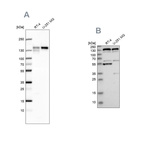 Western blot analysis using Anti-GOLGA2 antibody HPA021799 (A) shows similar pattern to independent antibody HPA021178 (B).