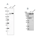 Western blot analysis using Anti-GOLGA2 antibody HPA021799 (A) shows similar pattern to independent antibody HPA021178 (B).