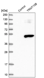 Western blot analysis in control (vector only transfected HEK293T lysate) and TRMT10B over-expression lysate (Co-expressed with a C-terminal myc-DDK tag (~3.1 kDa) in mammalian HEK293T cells, LY408102).