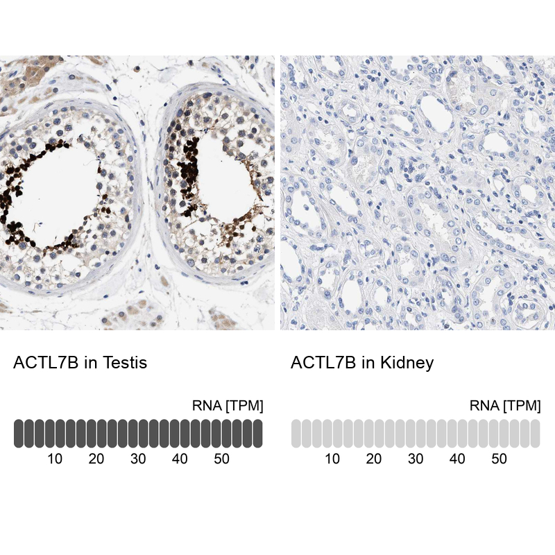 Anti-ACTL7B Antibody