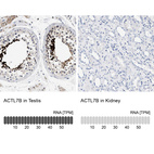 Anti-ACTL7B Antibody