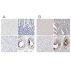 Immunohistochemical staining of human cerebral cortex, duodenum, kidney and testis using Anti-ACTL7B antibody HPA021803 (A) shows similar protein distribution across tissues to independent antibody HPA024664 (B).