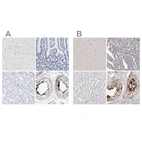 Immunohistochemical staining of human cerebral cortex, duodenum, kidney and testis using Anti-ACTL7B antibody HPA021803 (A) shows similar protein distribution across tissues to independent antibody HPA024664 (B).
