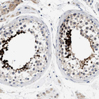 Immunohistochemical staining of human testis shows strong nuclear positivity in cells in seminiferous ducts.