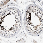Immunohistochemical staining of human testis shows strong nuclear positivity in cells in seminiferous ducts.