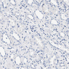 Immunohistochemical staining of human kidney shows no positivity in cells in tubules as expected.