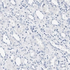Immunohistochemical staining of human kidney shows no positivity in cells in tubules as expected.