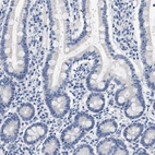 Immunohistochemical staining of human duodenum shows no positivity in glandular cells as expected.