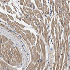 Immunohistochemical staining of human heart muscle shows moderate to strong cytoplasmic positivity in cardiomyocytes.