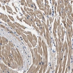 Immunohistochemical staining of human heart muscle shows moderate to strong cytoplasmic positivity in cardiomyocytes.