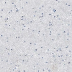 Immunohistochemical staining of human cerebral cortex shows no positivity in neurons as expected.