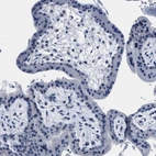 Immunohistochemical staining of human placenta shows no positivity in trophoblastic cells as expected.