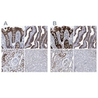 Anti-MKS1 Antibody