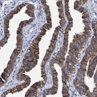 Immunohistochemical staining of human Fallopian tube shows strong membranous positivity in glandular cells.