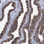 Immunohistochemical staining of human Fallopian tube shows strong membranous positivity in glandular cells.