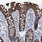 Immunohistochemical staining of human colon shows strong cytoplasmic positivity in glandular cells.