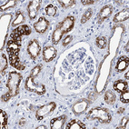Immunohistochemical staining of human kidney shows strong cytoplasmic positivity in cells in tubules.